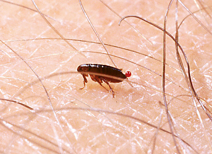 A flea sitting on a person's skin